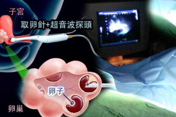 2023武汉三代试管婴儿医院排名最新，第三代试管包生男孩费用清单