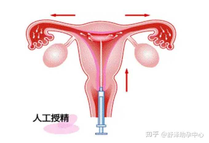 上海仁济医院供卵流程,上海供卵多少钱_正规试管代孕公司