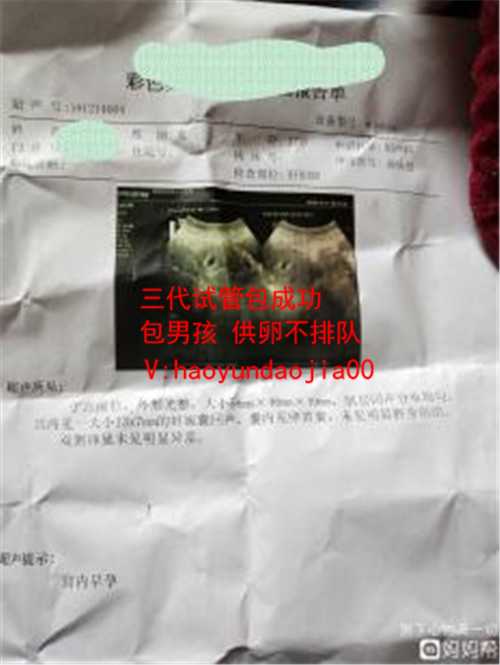 上海供卵试管移植两个_上海找可以做供卵的医院_孕妇服中药公立医院供卵引堕