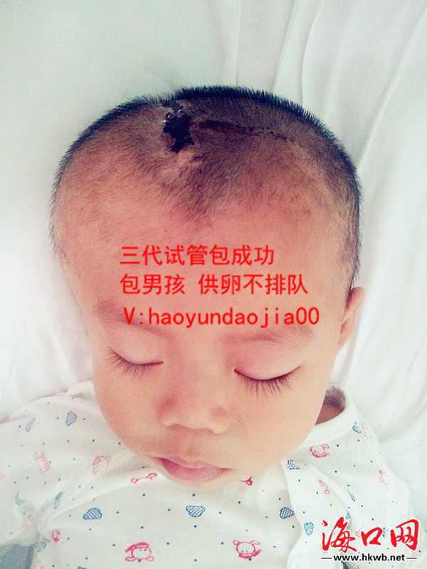 上海什么条件可以申请供卵_上海做供卵试管哪家好_试管婴儿胚胎移植后就等着